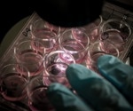 Using human iPSC-derived cells to revolutionize the field of neurodegenerative disease