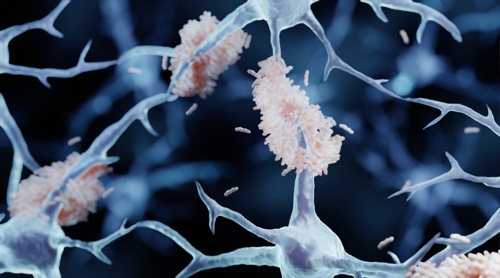 Study: Association of klotho protein levels and KL-vs heterozygosity with Alzheimer