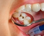 The association between e-cigarette use and caries risk level