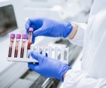 Correlating circulating adipokine levels with COVID-19 severity