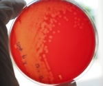 Recent surge in group A streptococcal infections among children in UK