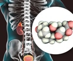 Association of aldosterone with ideal cardiovascular health in incident diabetes