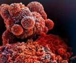 Pegylated interferon lambda shows good efficacy against COVID-19