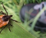 Report of a case of severe tick-borne encephalitis in a pregnant woman
