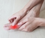 Effects of nanoparticles on gouty arthritis in animal models of gout