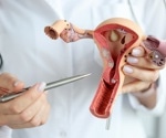 Natural product with grape seed extracts, lactic acid, and pea protein could effectively manage bacterial vaginosis
