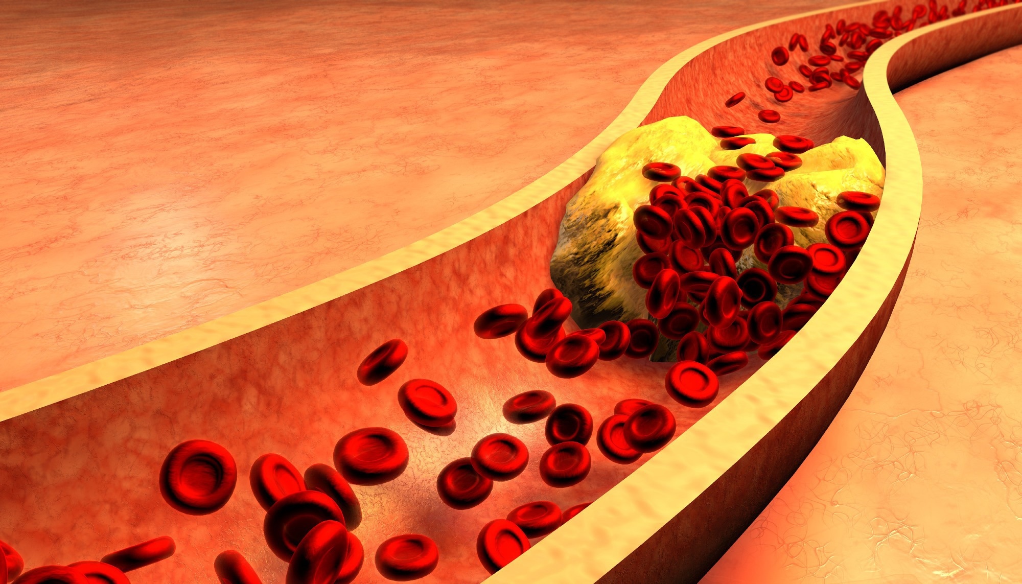 Study: A Review of Low-Density Lipoprotein-Lowering Diets in the Age of Anti-Sense Technology. Image Credit: Ralwell / Shutterstock