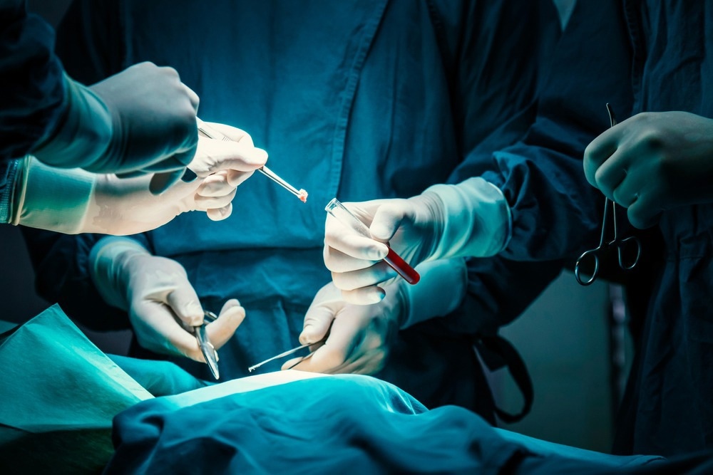 Tumor Biopsy