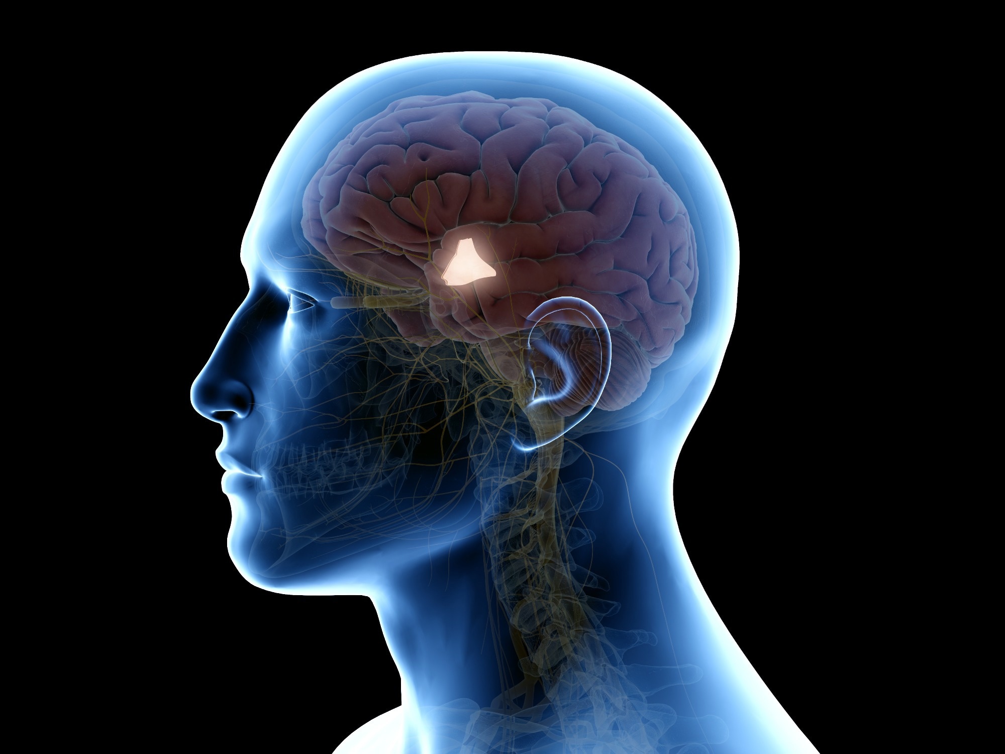 Study: Is human obesity an inflammatory disease of the hypothalamus? Image Credit: SciePro / Shutterstock