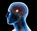 Hypothalamic inflammation and obesity, study suggests a pathological mechanism