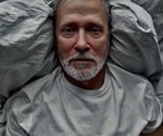 How does dietary intervention affect aging?