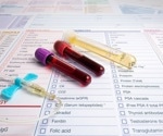 Biomarkers that can predict long COVID symptoms