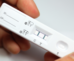 Overcoming challenges in Point of Care diagnostics in veterinary medicine