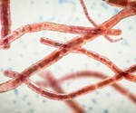 Case report on Nocardia pseudobrasiliensis and SARS-CoV-2 concomitant infection