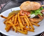 Interplay between Western diet, gut microbiota, and cancer development