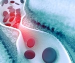 How nanomedicine is revolutionizing care for cardiovascular disease