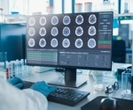 The Parkinson's Pandemic: from the importance of early diagnosis to digital solutions