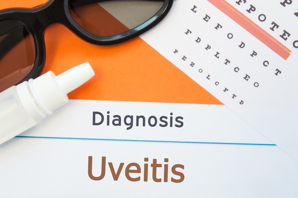Study: The Microbiome and Uveitis: A Narrative Review. Image Credit: Shidlovski/Shutterstock.com