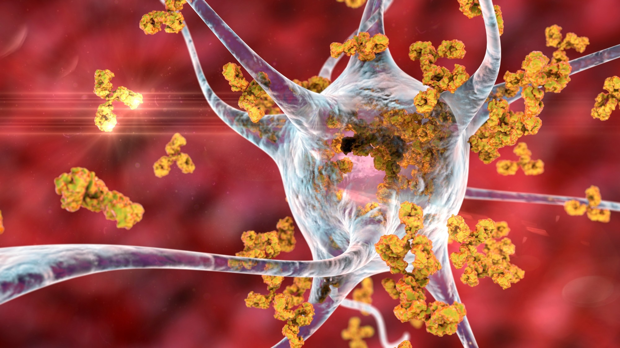 Study: High risk of autoimmune diseases after COVID-19. Image Credit: KaterynaKon/Shutterstock.com Background
