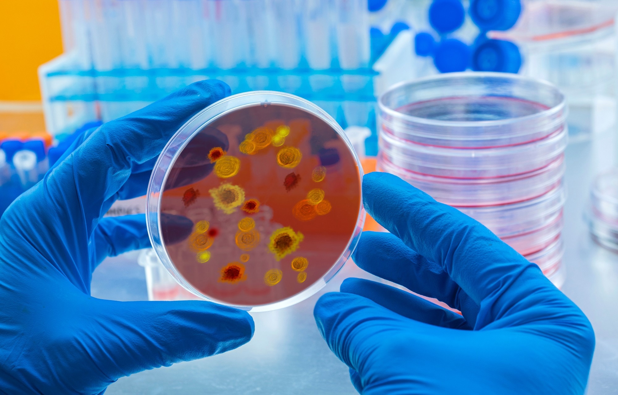 Study: CMPK2 restricts Zika virus replication by inhibiting viral translation. Image Credit: felipe caparros / Shutterstock