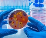 Study reveals CMPK-2 protein-coding gene as a potent inhibitor of flaviviruses
