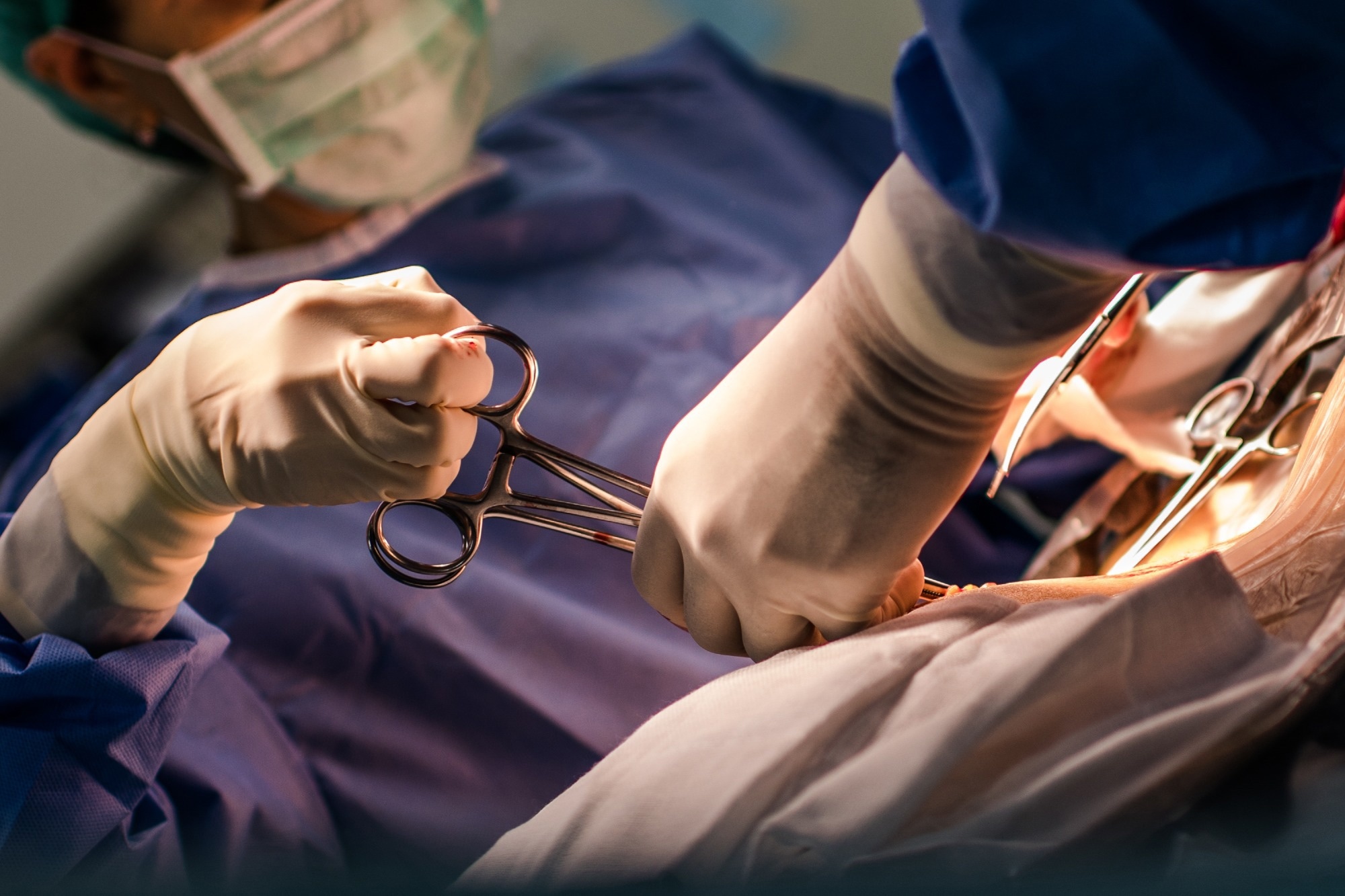 Study: Caesarean section and childhood obesity at age 3 years derived from the Japan Environment and Children’s Study. Image Credit: Natthawon Chaosakun / Shutterstock.com