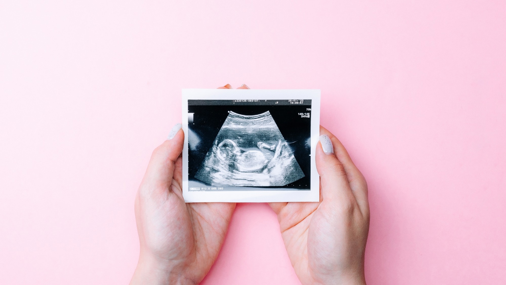 Review: Beyond sex differences: short- and long-term effects of pregnancy on the brain. Image Credit: MVelishchuk / Shutterstock
