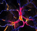 Gut bacteria toxins: A hidden trigger for Parkinson's disease?