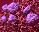 Multiple sclerosis: Immune cell invasion enabled by blood-brain barrier breakdown