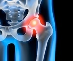 Study compares long-term consequences of COVID-19 between patients with rheumatic inflammatory diseases and healthy controls