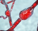 Study shows Alzheimer’s disease-associated retinopathy can be ameliorated by dietary lysophosphatidylcholine-EPA/DHA