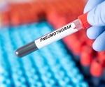Pneumothorax prevalence in COVID-19 and influenza patients