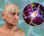 Connecting the inflammatory dots: Obesity, depression, and Alzheimer's linked by neuroinflammation