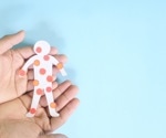 Deep learning models could be crucial in battling the monkeypox virus