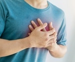 What are the potential long-term effects on healthcare and the economy due to decreased STEMI treatment during the COVID-19 pandemic?