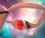 Is there an association between COVID-19 vaccination and changes in ovarian reserve?