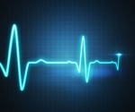 Improved diagnosis of occlusion myocardial infarction using novel machine learning tools