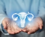 How B-cells and androgens contribute to the development of PCOS