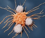Immunodiagnosis: Unleashing the potential of personalized immunotherapy