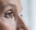 The role of diet in the management of retinal vein occlusion