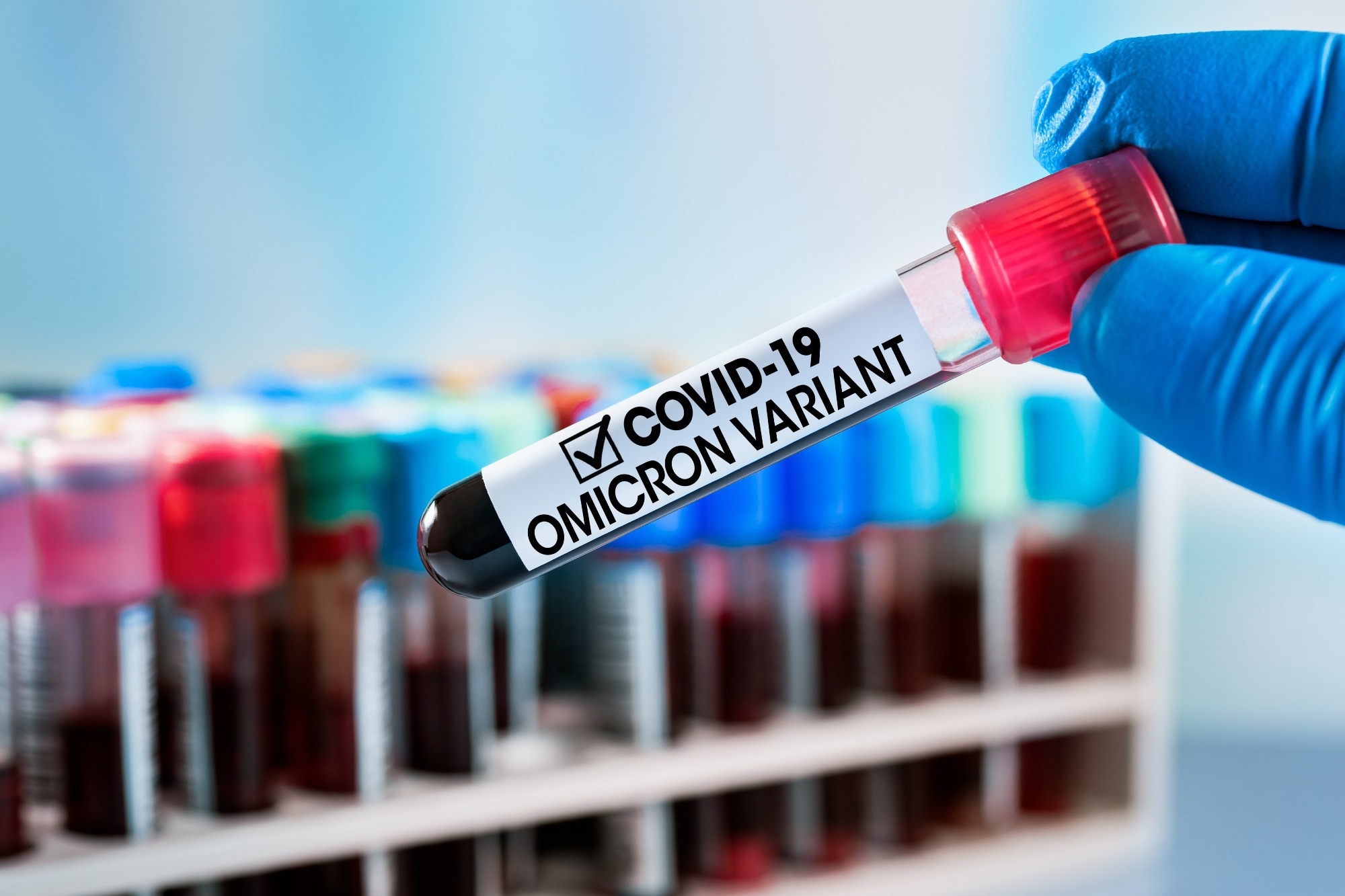 Study: Antibody responses following the surge of SARS-CoV-2 Omicron infection among patients with systemic autoimmune rheumatic diseases. Image Credit: angellodeco/Shutterstock.com