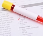 Study assesses the value of predictive biomarkers for early-stage COVID-19 infection