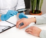 Is COVID-19 vaccination linked to psoriasis emergence or flare-ups?
