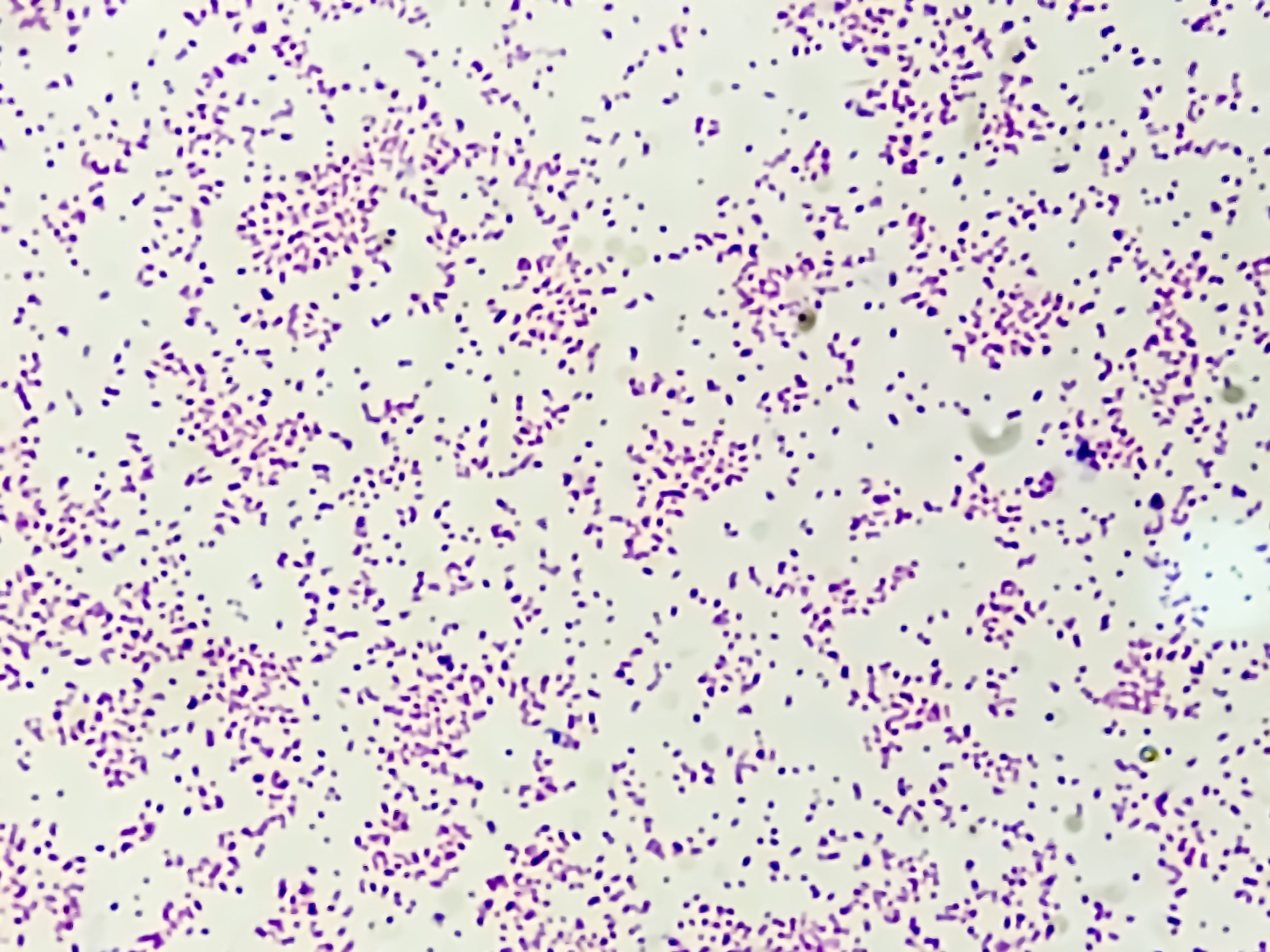 Increased incidence of teicoplanin-non-susceptible Staphylococcus epidermidis strains: a 6-year retrospective study