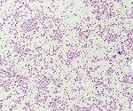 Are teicoplanin-non-susceptible Staphylococcus epidermidis strains increasing?