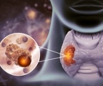 The immune-modulatory effect of lenvatinib investigated in new study