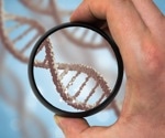 What are some recent advancements in proteomics-driven pancreatic oncology research?