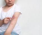 The standard of care and recent advancements in the control of skin inflammation