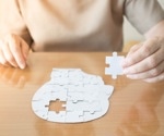 Aligning Rhythms, Defying Alzheimer's: Intermittent Fasting's Role in Combating Alzheimer's Disease Neurodegeneration