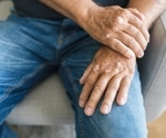 Is DNA methylation the missing link in diagnosing and treating psoriasis and psoriatic arthritis?